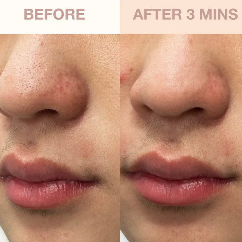 Deepcare O2 Hydro-Facial Pore Refiner & ABC Serum Bundle